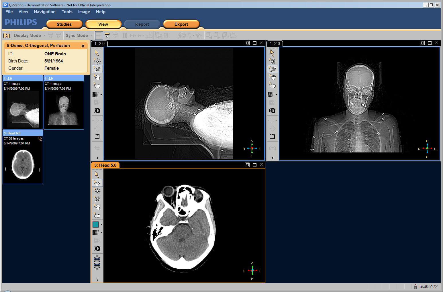 PhilipsDicomViewer - Presented by PostDICOM